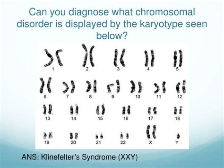 By analyzing the karyotype what chromosomal disorder is present?