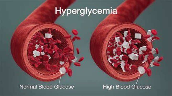 Does hyperglycemia cause somnolence?