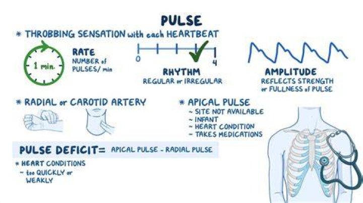 Does thready pulse mean?