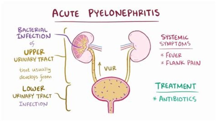 How is pyelonephritis treated?