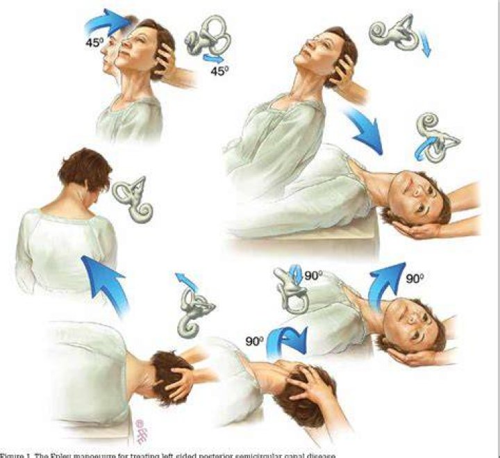 Is epley maneuver dangerous?