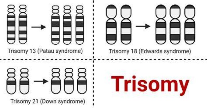When do trisomies occur?