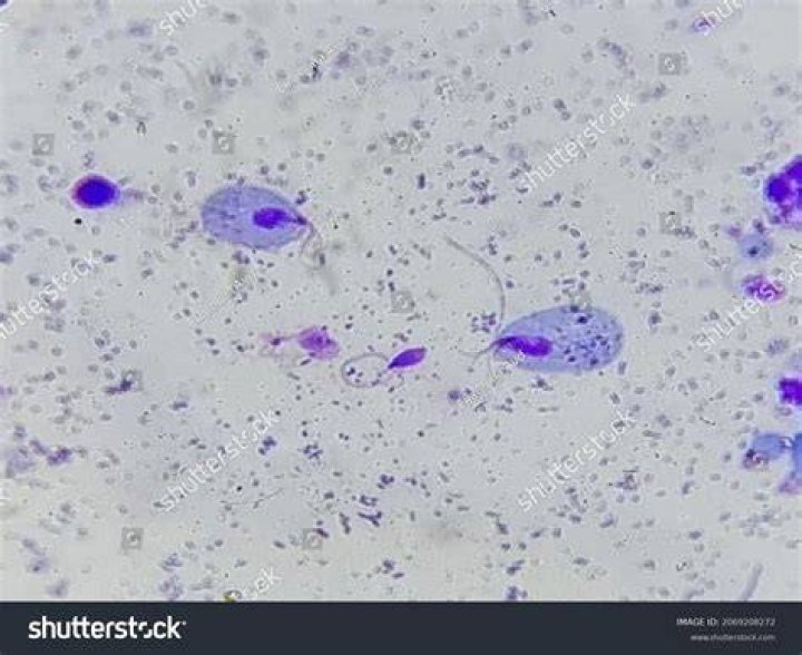 Which of the following is a flagellated protozoan?